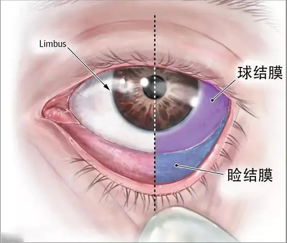 的粘膜组织,覆盖在眼睑后面和眼球前面,分睑结膜,球结膜,穹窿部结膜