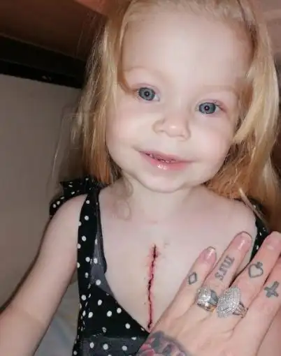 英3岁女孩出生时只有半颗心脏,其母曾被6次建议终止妊娠