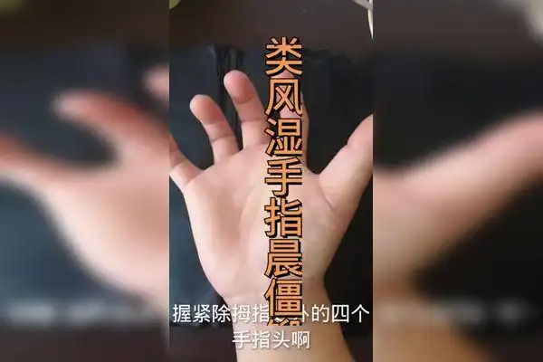 坚持锻炼 鹰爪操每天做一做类风湿手指晨僵消失了 #每天坚持锻炼商邋