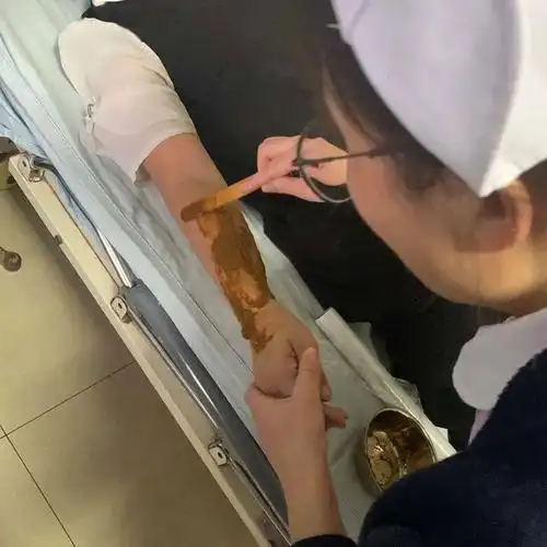 宁津县中医院中医特色疗法-贴敷疗法