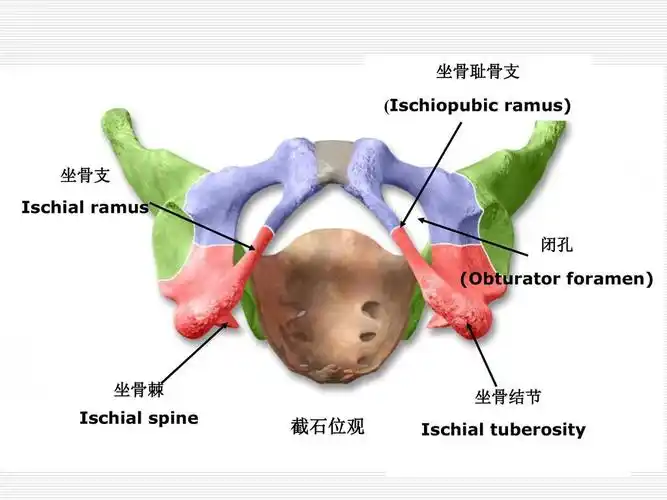 坐骨结节滑囊炎小针刀疗法一
