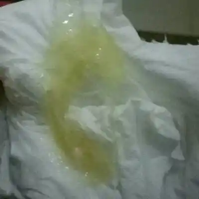 孕三十九周多,几天没有分泌物,突然出来了这样的,像鼻涕似的,什麼东西