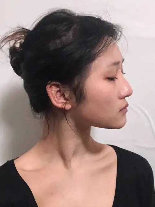 美图全靠秀我的塌鼻梁怎么办