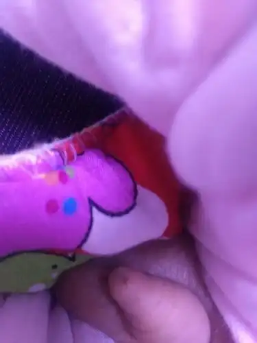 求助宝妈门,看来看看这是怎么了