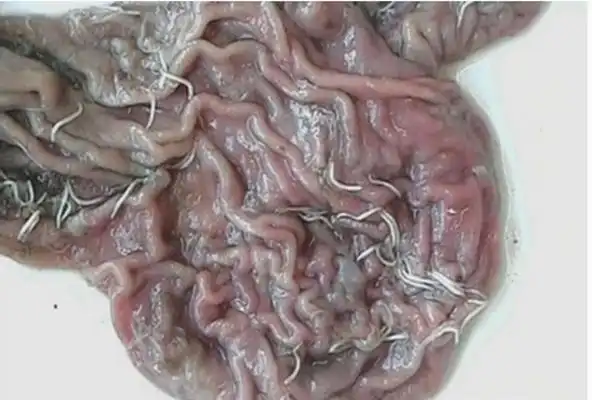 儿童肚子蛔虫图片 (40)_有来医生