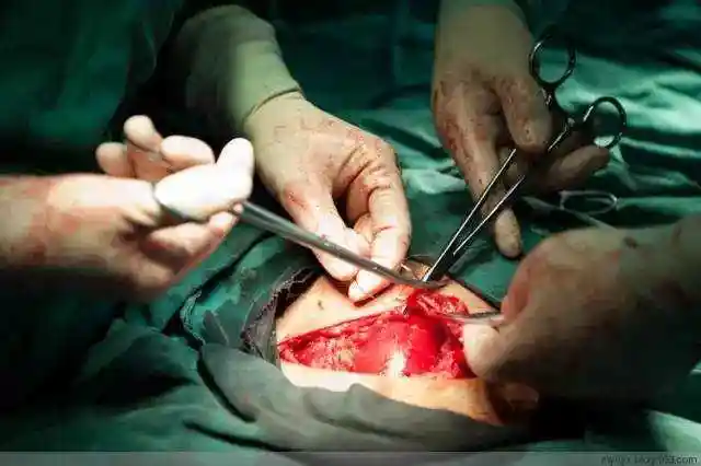 百张照片再现剖腹产全程 妈妈真的太伟大了(组图)