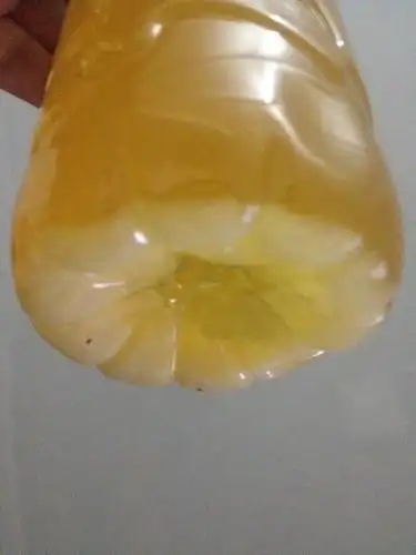 小孩尿白色沉淀物图片