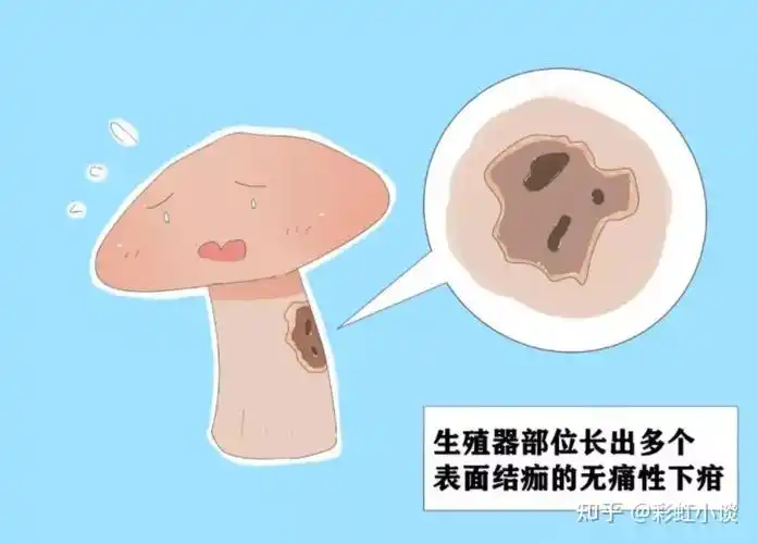 一期梅毒会出现硬下疳,一般持续3-8周后会自愈.