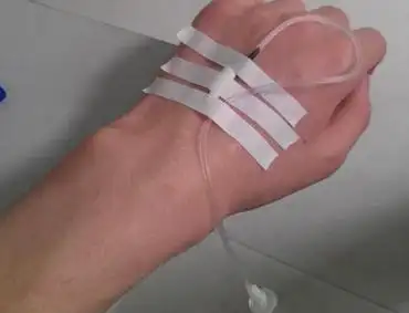 求一张女生手部输液的照片 - 你问我答网