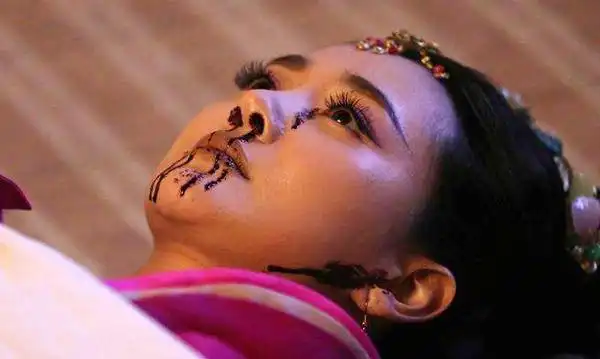 七窍流血是哪七窍成因是什么