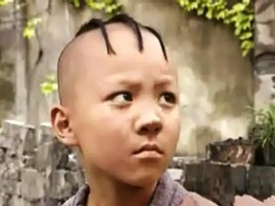 34岁"三毛"变帅哥,8岁成名,14岁秃顶,植发挨300多针