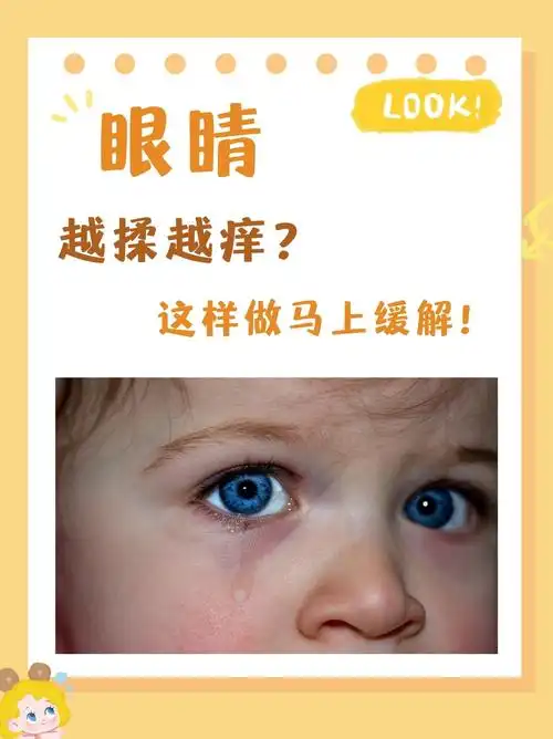 眼睛很痒,越揉越痒怎么办?