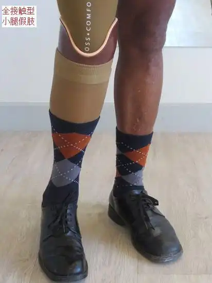 小腿假肢的类型