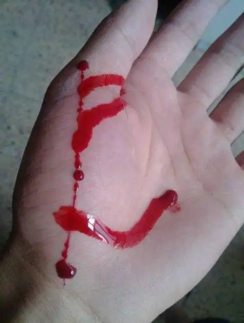 手划伤出血真实的大伤 - 搜狗图片搜索