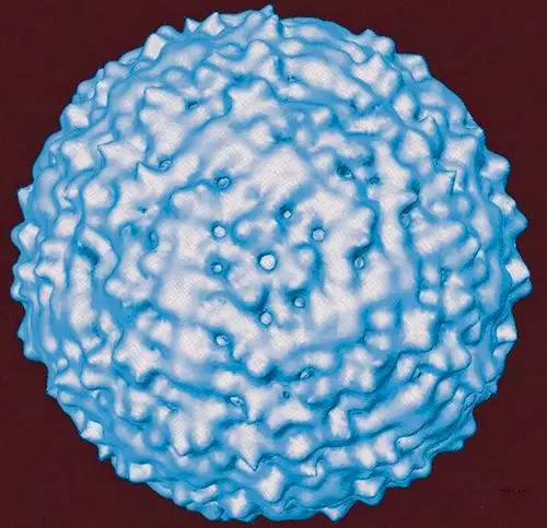 埃博拉病毒继续蔓延回顾人类历史上最骇人的十大病毒