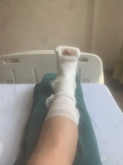 胫腓骨骨折内外踝骨折的过程