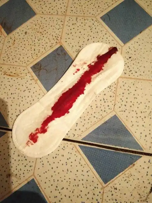 结束的姨妈 9日晩那啥 10号中午买的金毓婷吃了之后 16号流了一整天血