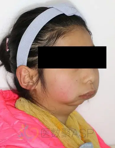 拿什么拯救我的小下巴