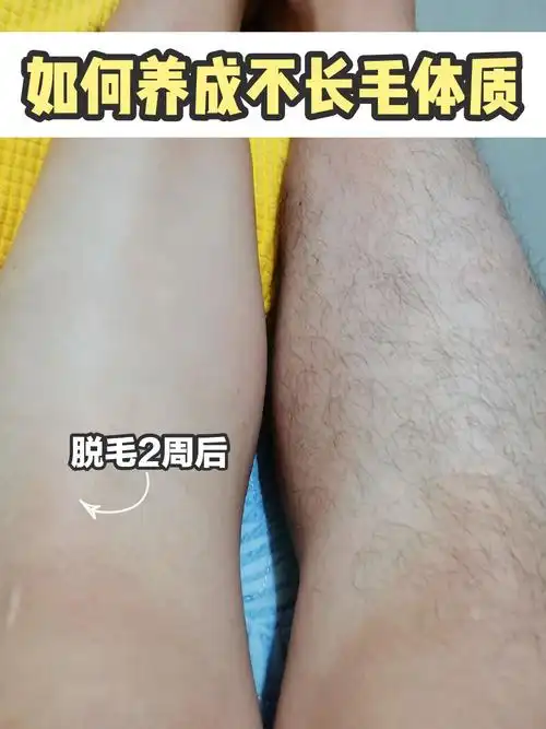 脱毛3年我已经很久没长毛了60绝毛