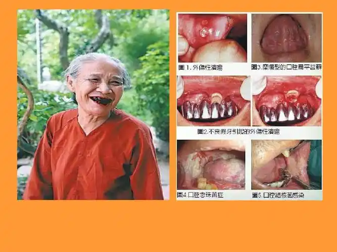 青少年吸烟的危害ppt