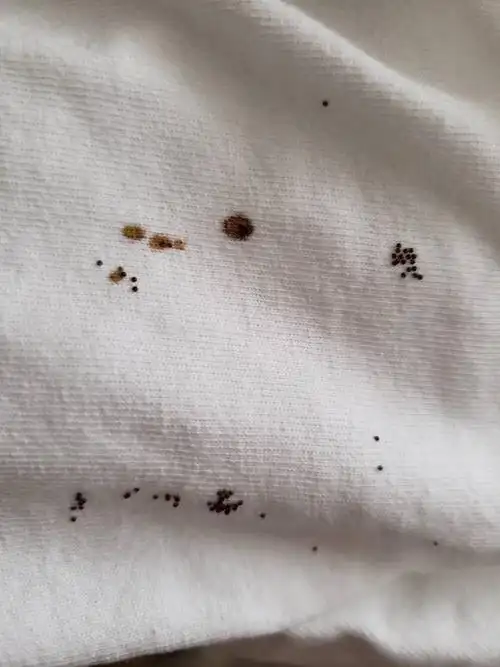 这个是什么虫子的卵