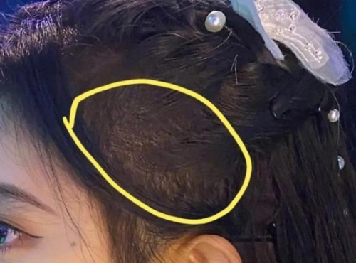 鞠婧祎发量又一次"翻车",密密麻麻头皮太假被吐槽,密集恐惧症患者慎入