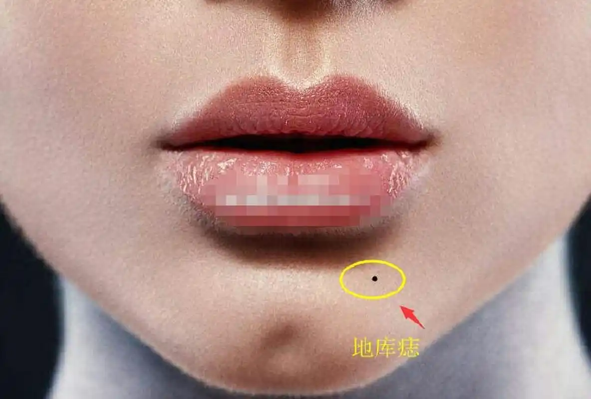 古话长说"地库长黑痣,富裕一辈子"你的地库有黑痣吗?