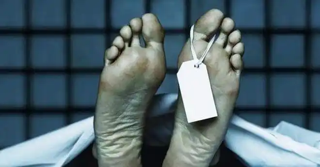 死亡超过48小时因公牺牲 - 实验室设备网