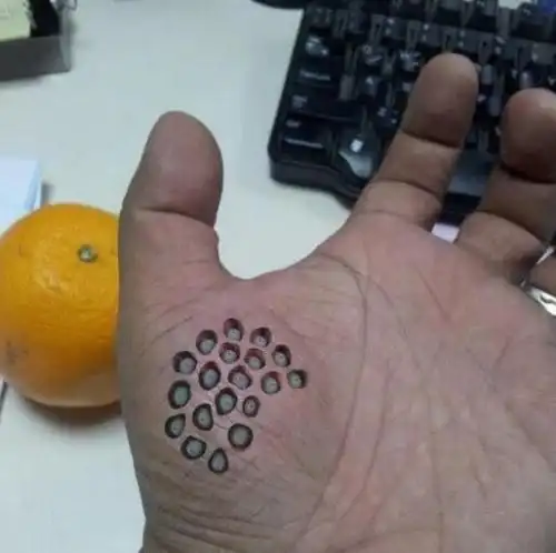 莲蓬乳和空手指是真的吗空手指莲蓬乳恶心图片大全2