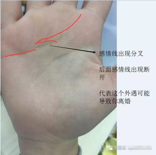 第三:如果感情线出现一个比较大的分叉,分叉后,感情线出现断开,代表
