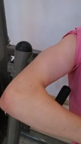 女生这手臂怎样