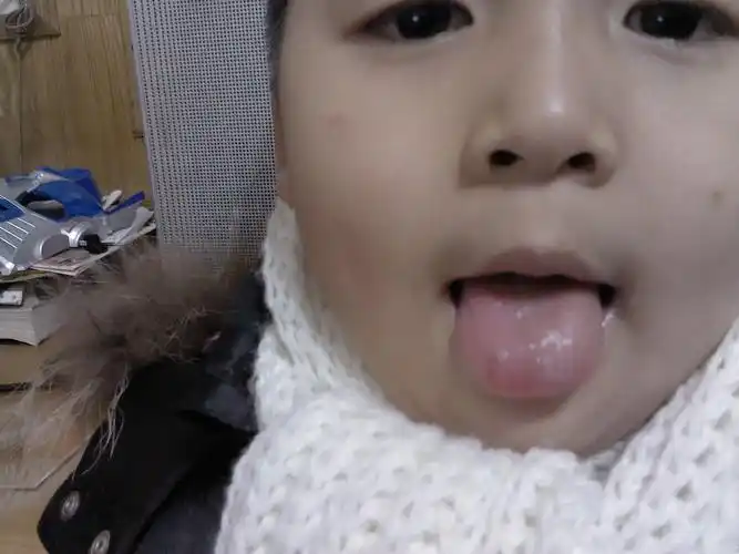 小孩舌头长白白的颗粒怎么回事