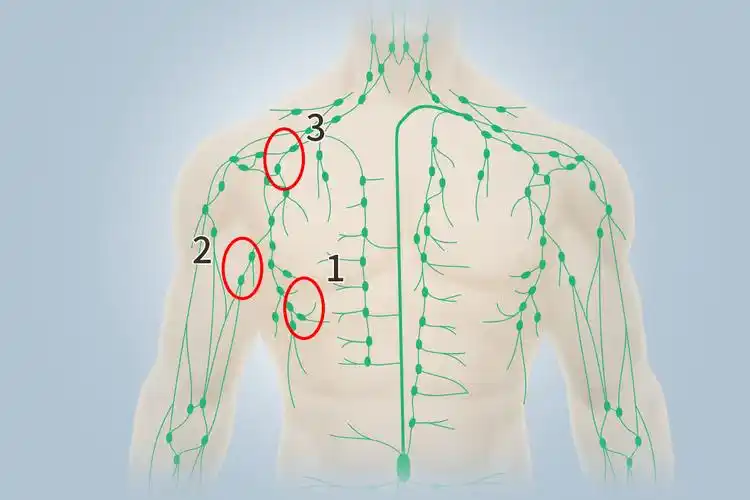 腋窝一二三组淋巴结图片