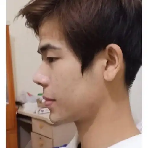 侧脸有问题吗各位给点意见谢谢