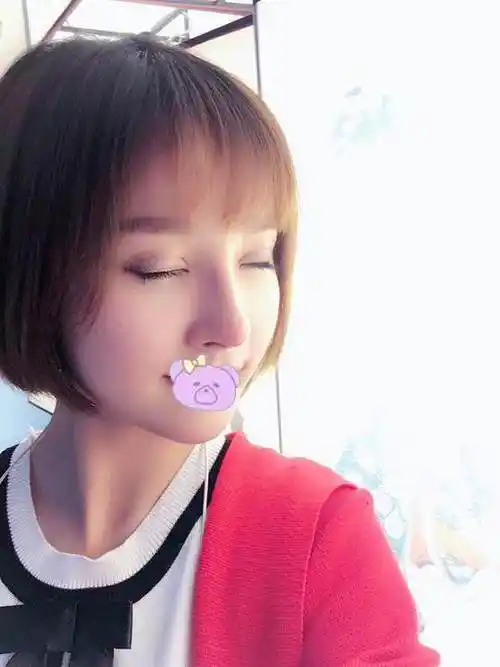 【真人案例】猪鼻子做鼻综合直接变成韩佳人同款小翘鼻