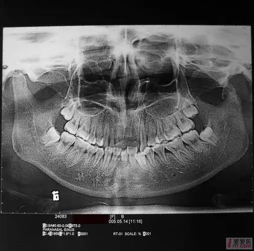 求些口腔的x光片