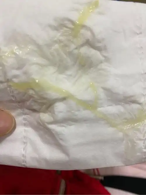 请问.这是宫颈粘液么