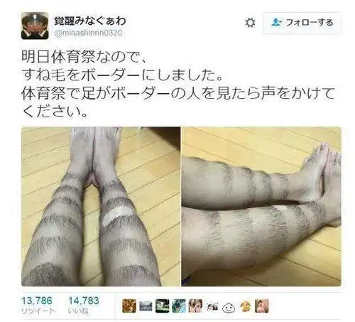 男生前卫腿毛爆红(图) 网友:这造型我给100分!