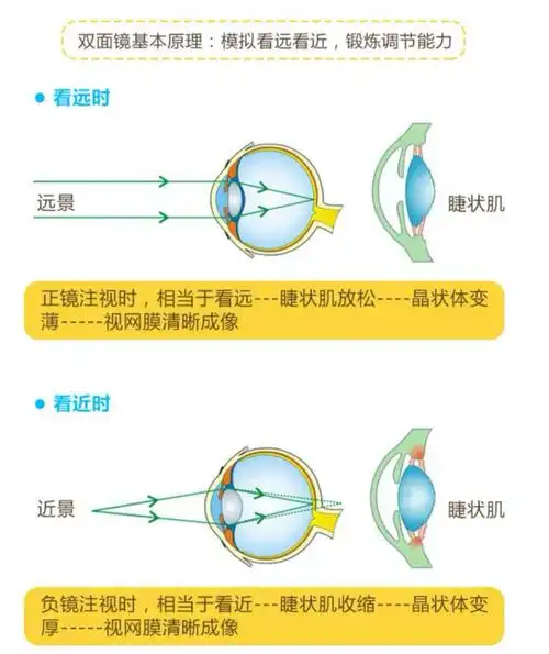 近视矫正手术后调节力的康复训练