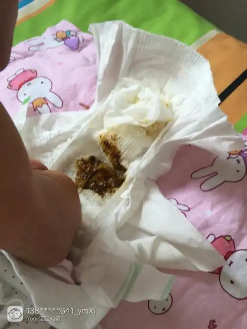 宝宝第16天,吃了茵栀黄,拉粑粑这颜色对吗?