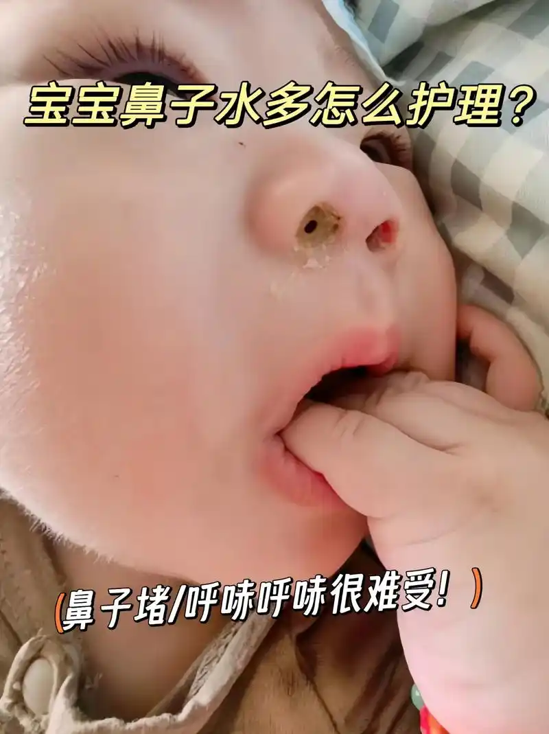 宝宝鼻子哼呲哼呲的,还堵了,可难受!建议妈妈们用上子初的海盐 - 抖音