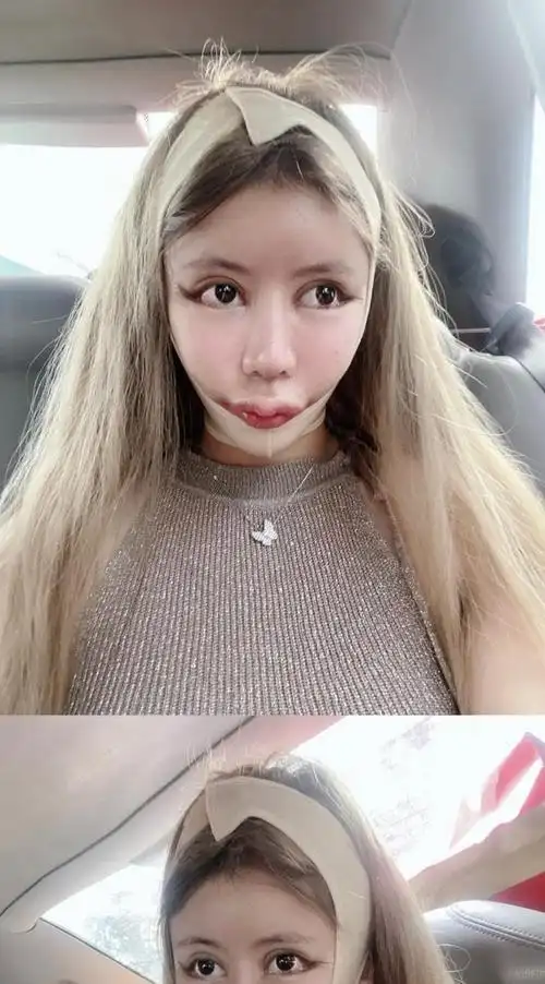 13岁开始整容,砸50万整成"芭比娃娃",如今16岁她成这般模样