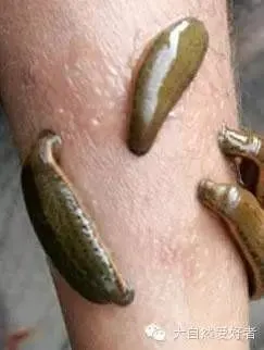 蚂蝗吸血蚂蝗吃什么