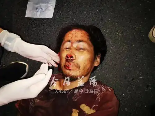 紧急寻找家属益阳一男子路遇车祸抢救无效死亡