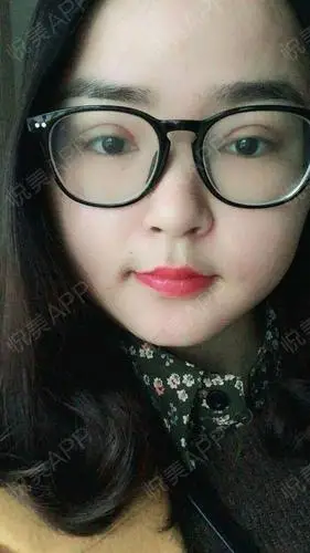 全切双眼皮术后7天_双眼皮术后7天_眼部整形术后7天_阜阳黛莱美医疗