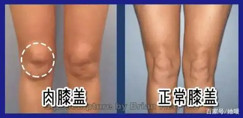 2020女生体重标准又变了,120斤以下都是女神身材?