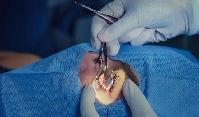 重睑术的手术方式繁多,难以达到统一,重睑相关上睑下垂可以根治