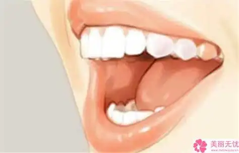 长春市牙龈增生医生排名top10名单曝光长春市苏冠方口腔医生