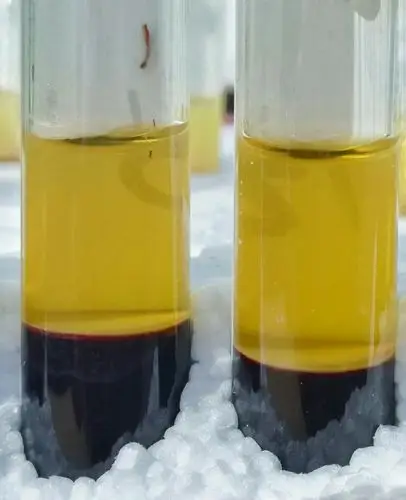 正常血液离心后,上层为血清(清澈透明,淡黄色),甘油三酯 1.