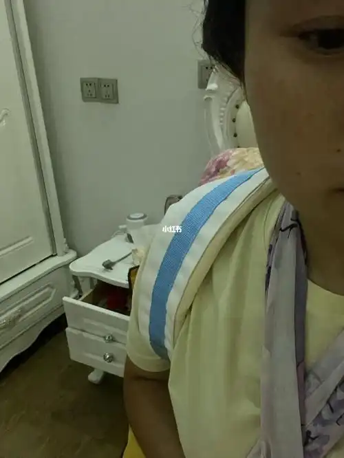 锁骨骨折第一天,彻夜难眠
